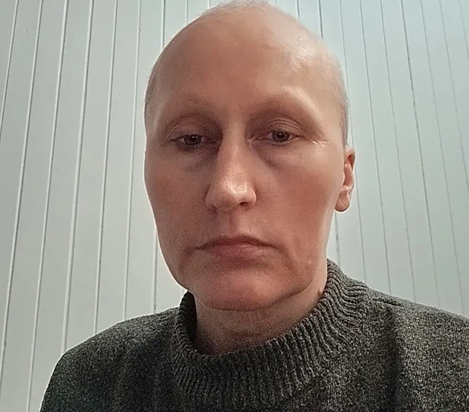 cancer-kwadrat-Aneta Mikołajczyk - Ekstowicz