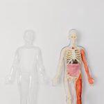 zespoły mielodysplastyczne