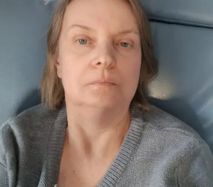 cancer-kwadrat-Teresa Nowak