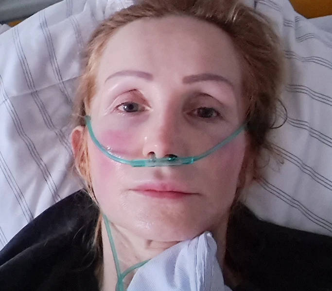 cancer-kwadrat-Ewa Kadyła-Stolarz