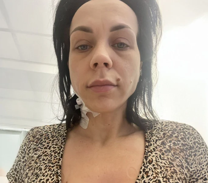 cancer-kwadrat-Marlena Piątek