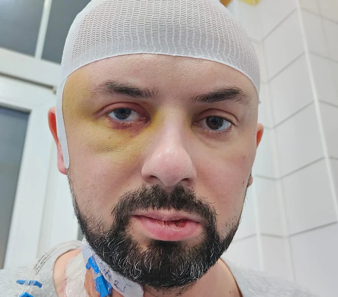 cancer-kwadrat-Martin Sobczak