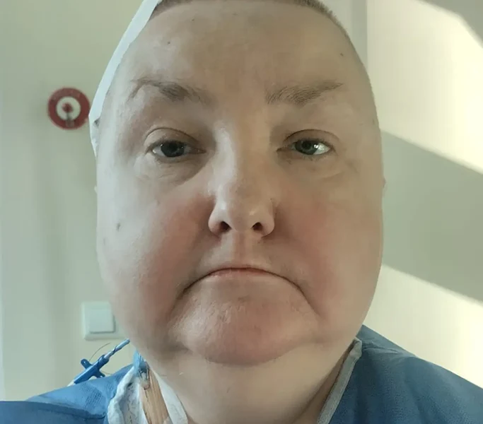 cancer-kwadrat-Mirosława Pukacz