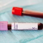 objawy nadpłytkowości